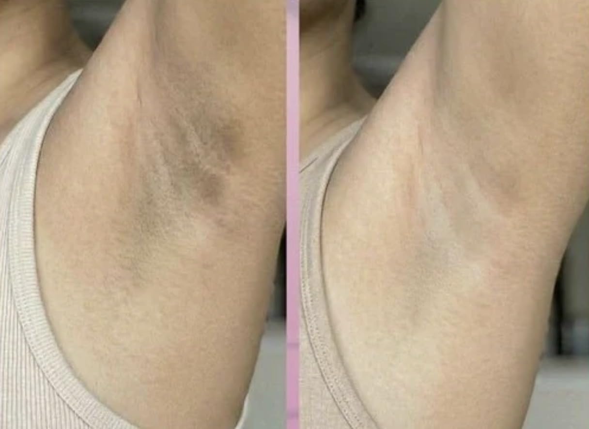 Exfoliante Melaxine